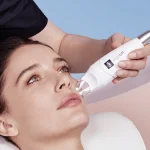 lpg - alliance - visage